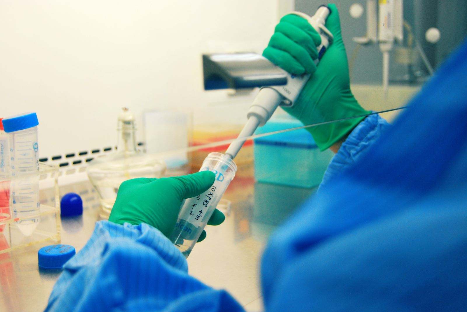 成都亲子鉴定支持哪些特殊样本？指甲、牙刷、烟蒂等也能用吗？